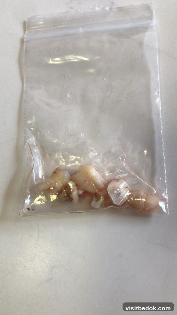 Bag of Teeth
