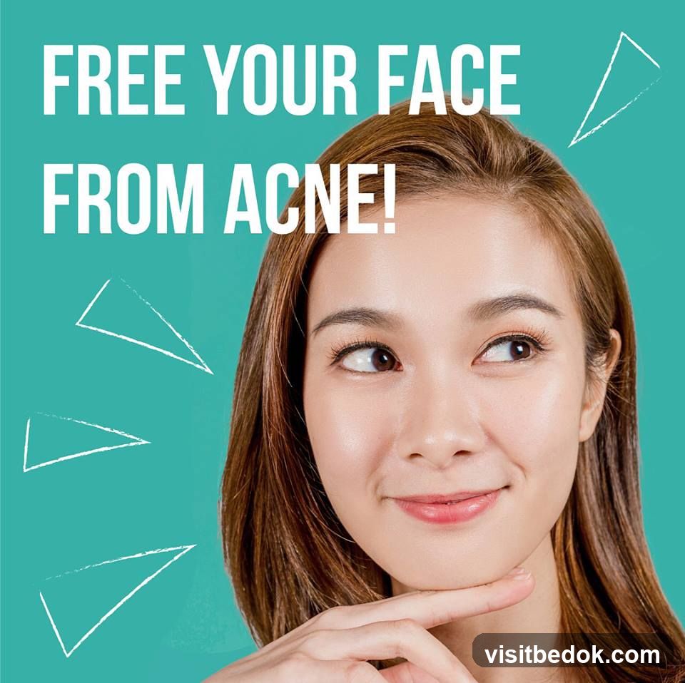 Free Your Face From Acne!