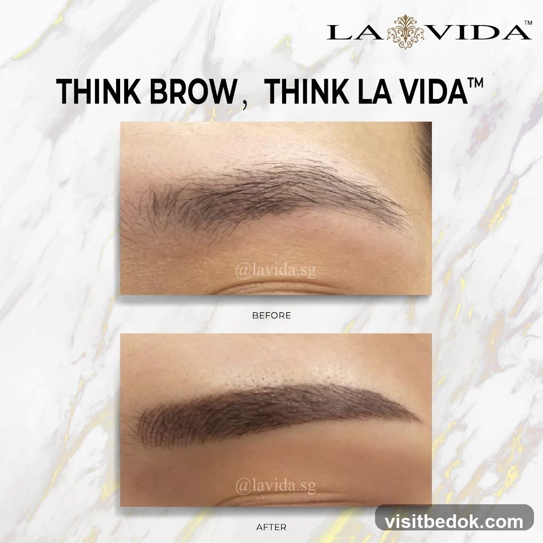 Eyebrow Before and After
