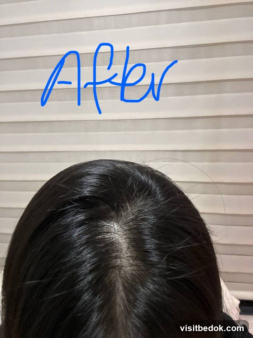 Hair after treatment