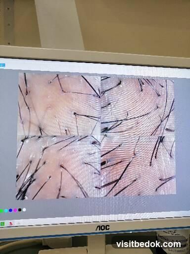 Magnified Skin View