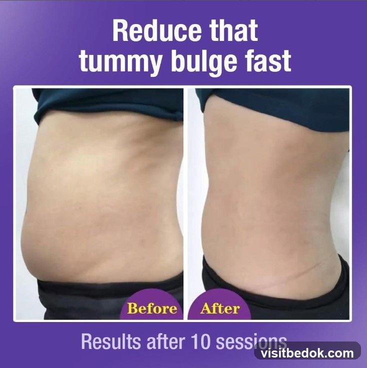 Before and After Tummy Bulge Reduction