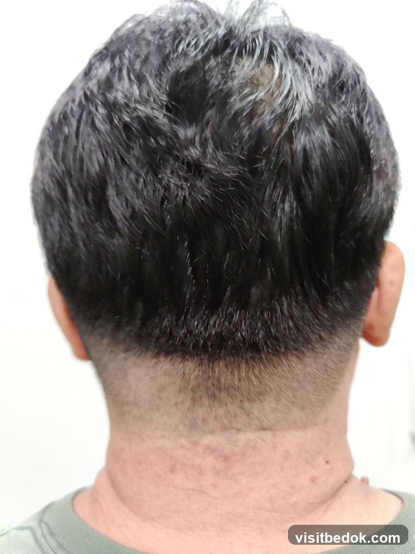 Back of Head and Neck