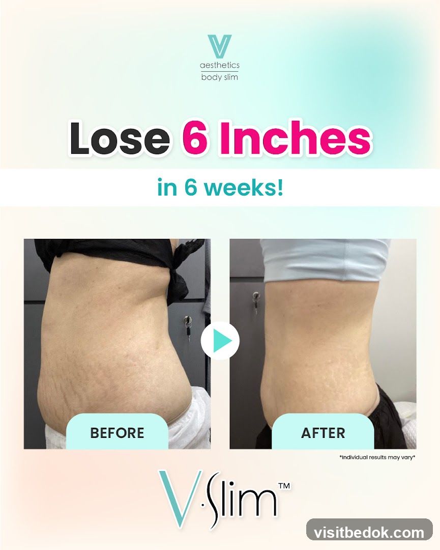 V Slim Before and After