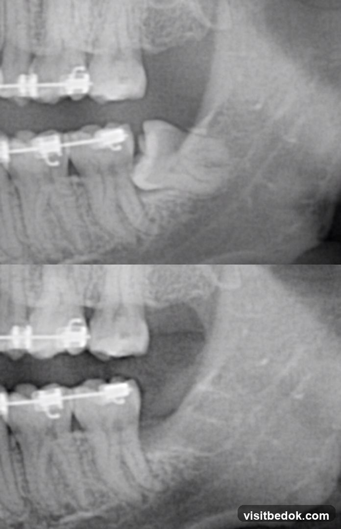 Dental X-ray