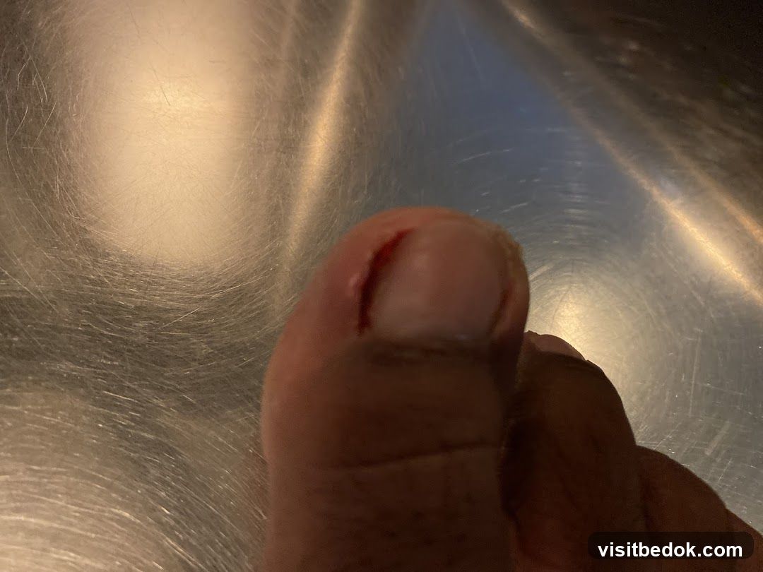 Close-up of a toe with a cut